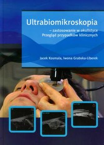 Ultrabiomikroskopia - zastosowanie w okulistyce. Przegląd przypadków klinicznych (wyd.1)