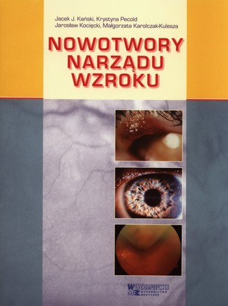 Nowotwory narządu wzroku