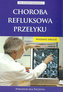 Choroba refluksowa przełyku Poradnik dla pacjenta