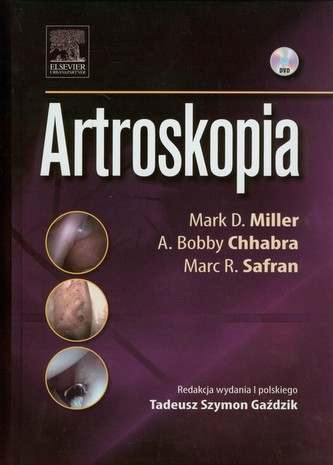 Artroskopia