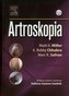 Artroskopia