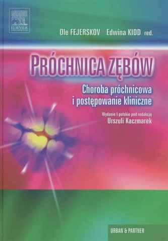Próchnica zębów
