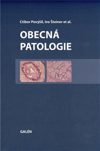 Obecná patologie