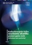 Radiochirurgická léčba neurinomu akustiku pomocí gama nože