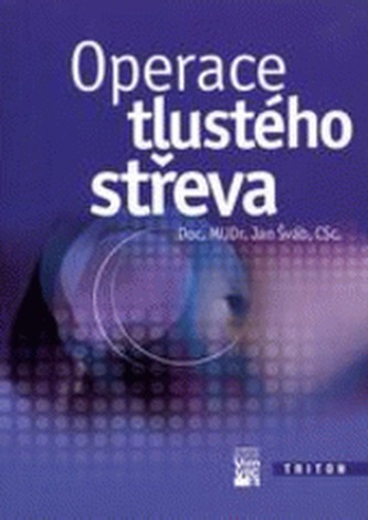 Operace tlustého střeva