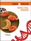 Sickle Cell Disease