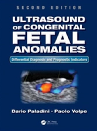 Ultrasound of Congenital Fetal Anomalies