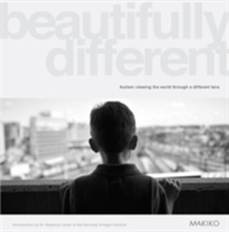 Beautifully Different