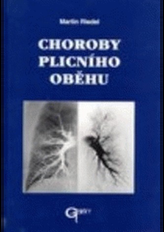Choroby plicního oběhu