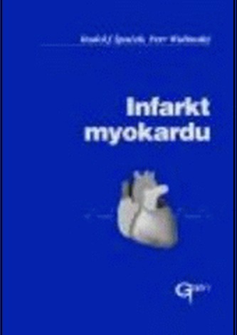 Infarkt myokardu