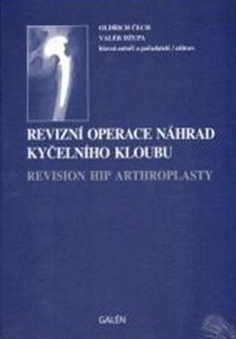 Revizní operace náhrad kyčelního kloubu