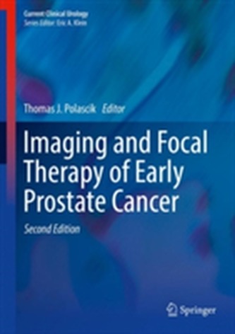 Imaging and Focal Therapy of Early Prostate Cancer