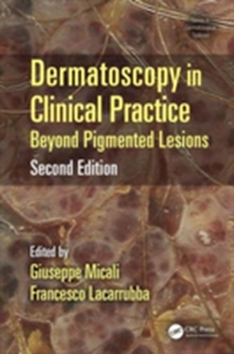 Dermatoscopy in Clinical Practice, Second Edition
