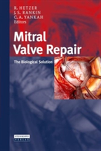 Mitral Valve Repair