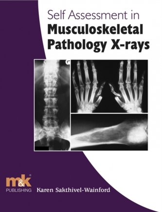 Self-assessment in Musculoskeletal Pathology X-rays