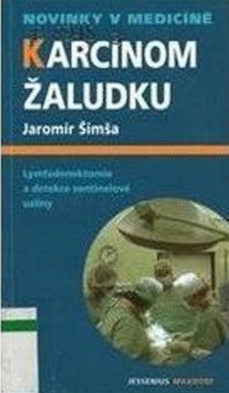 Karcinom žaludku