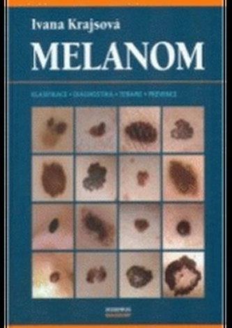Melanom