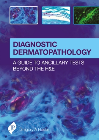 Diagnostic Dermatopathology: A Guide to Ancillary Tests Beyond the H&E;