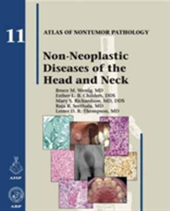 Non-Neoplastic Diseases of the Head and Neck
