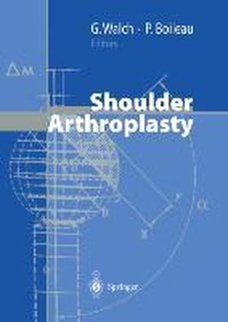 Shoulder Arthroplasty