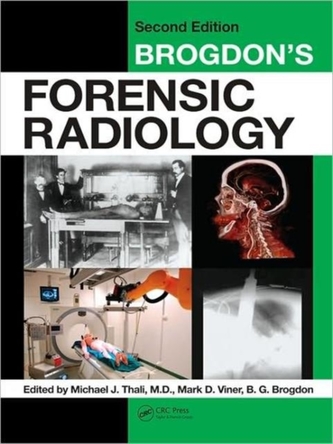 Brogdon's Forensic Radiology