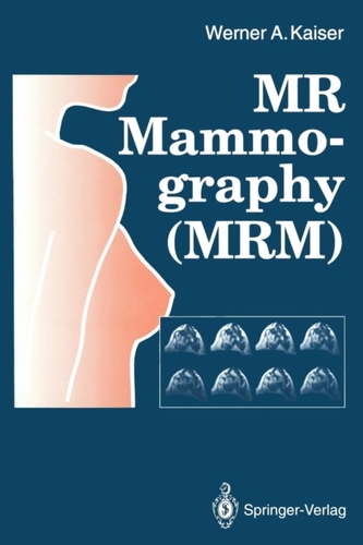 MR Mammography (MRM)