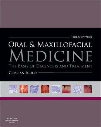Oral and Maxillofacial Medicine