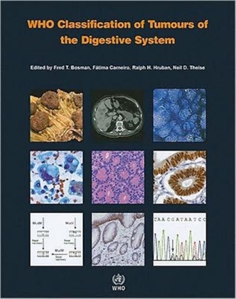 WHO classification of tumours of the digestive system