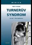Turnerův syndrom