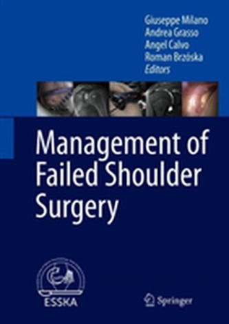 Management of Failed Shoulder Surgery