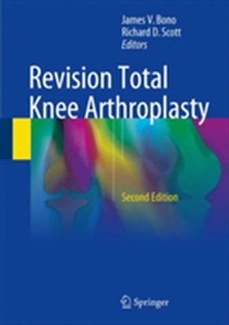 Revision Total Knee Arthroplasty