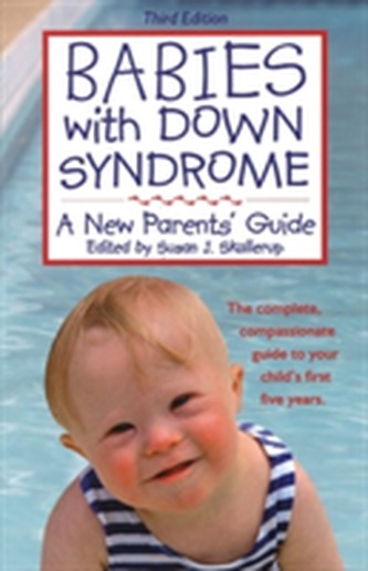 Babies with Down Syndrome