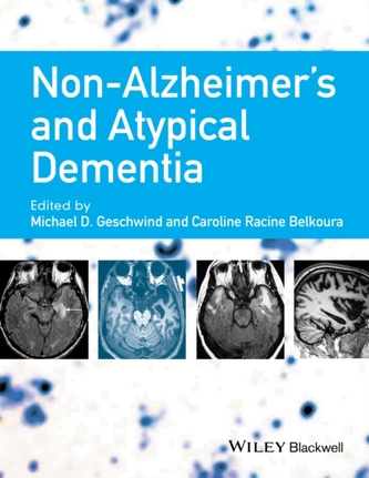 Non-Alzheimer's and Atypical Dementia