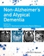 Non-Alzheimer's and Atypical Dementia