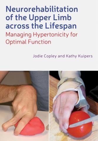 Neurorehabilitation of the Upper Limb Across the  Lifespan - Managing Hypertonicity for Optimal     Function