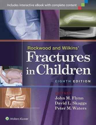 Rockwood and Wilkins' Fractures in Children