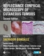 Reflectance Confocal Microscopy of Cutaneous Tumors, Second Edition