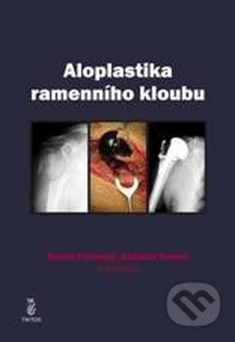 Aloplastika ramenního kloubu