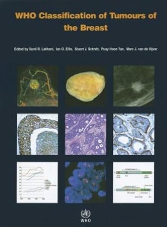 WHO classification of tumours of the breast