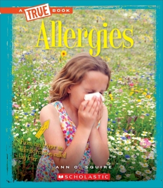 ALLERGIES