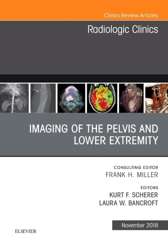 Imaging of the Pelvis and Lower Extremity, An Issue of Radiologic Clinics of North America