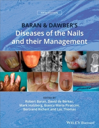 Baran and Dawber's Diseases of the Nails and their Management