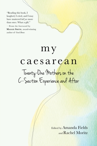 My Caesarean
