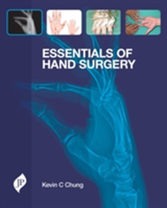 Essentials of Hand Surgery
