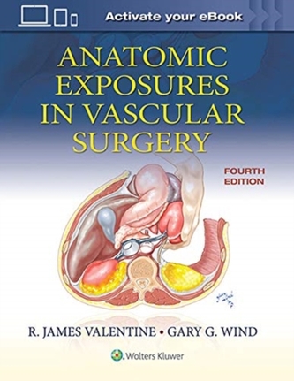 Anatomic Exposures in Vascular Surgery
