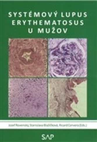 Systemovy lupus erythematosus u muzov