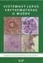 Systemovy lupus erythematosus u muzov