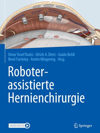 Roboterassistierte Hernienchirurgie