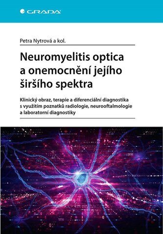 Neuromyelitis optica a poruchy jejího širšího spektra Neuromyelitis optica a poruchy jejího širšího spektra