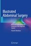 Illustrated Abdominal Surgery
